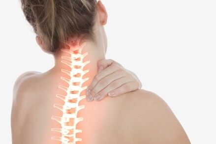 Servikal osteokondroz